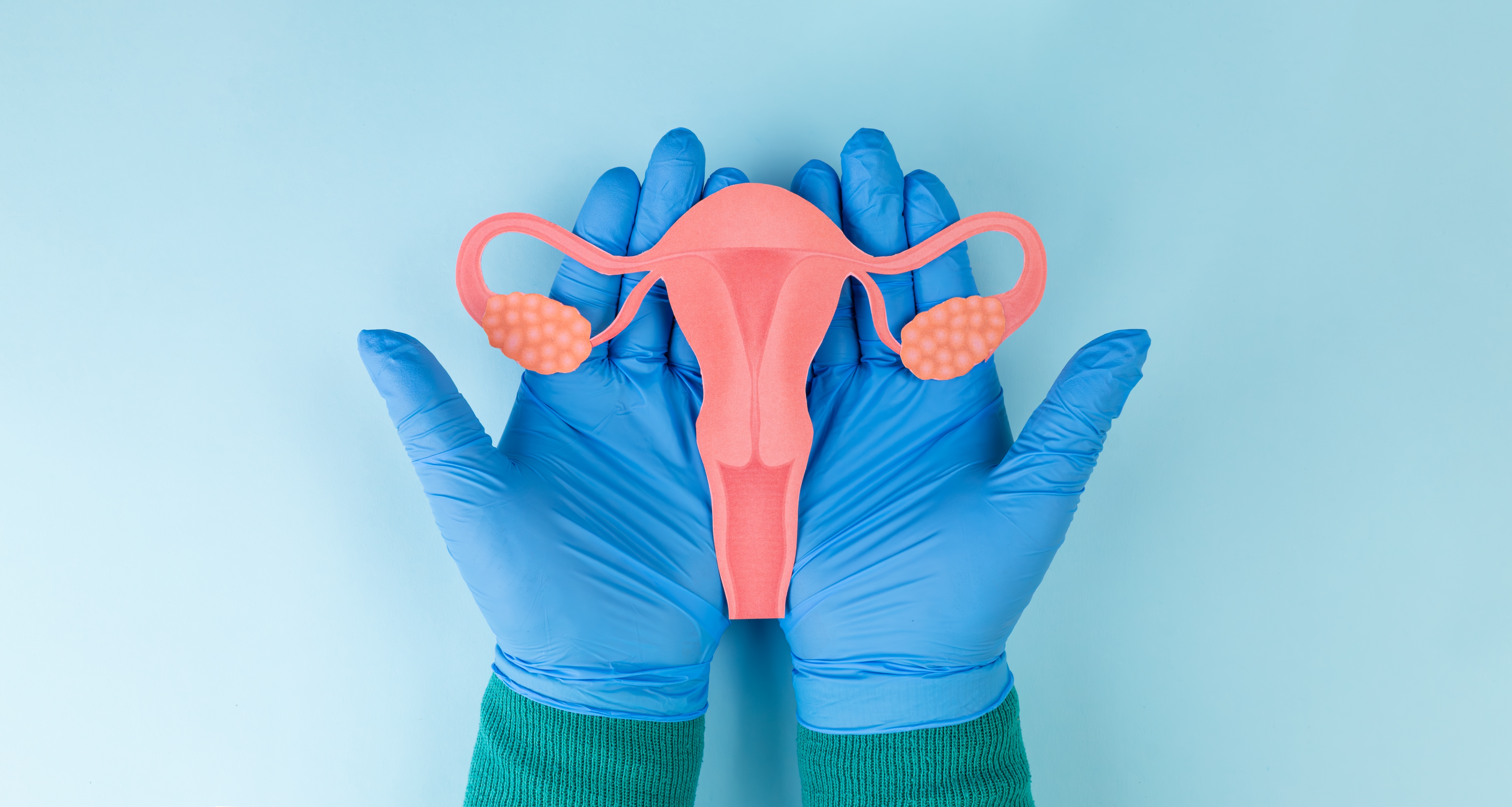 A,Gynecologist's,Hands,Are,Shown,Holding,A,Cardstock,Uterus,Against